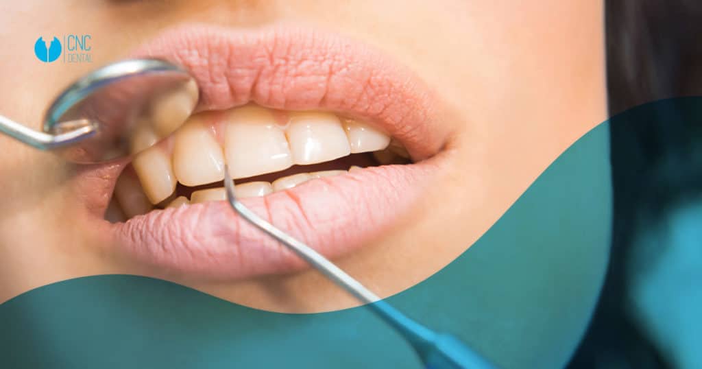 cuáles son las enfermedades periodontales y cómo tratarlas