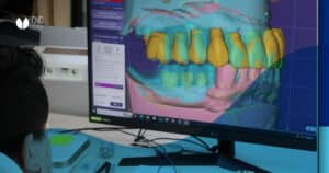 Diseño-digital-prótesis-dentales-CNC
