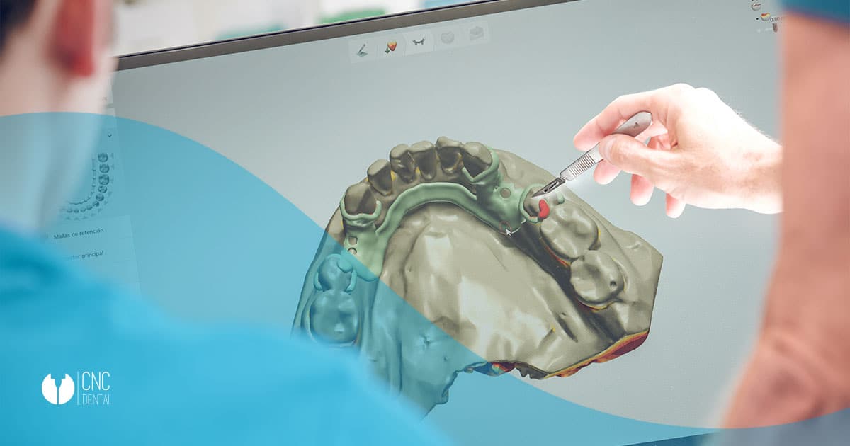 removible-digital-protesis-cnc