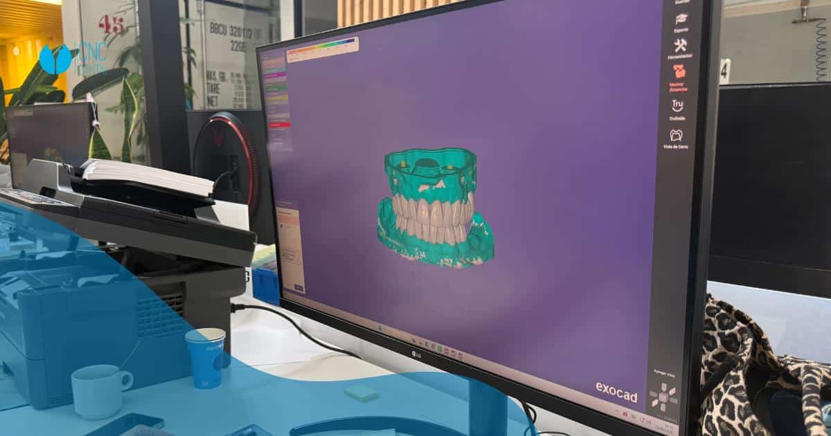 Diseño digital dental: la clave de la precisión en las prótesis actuales.